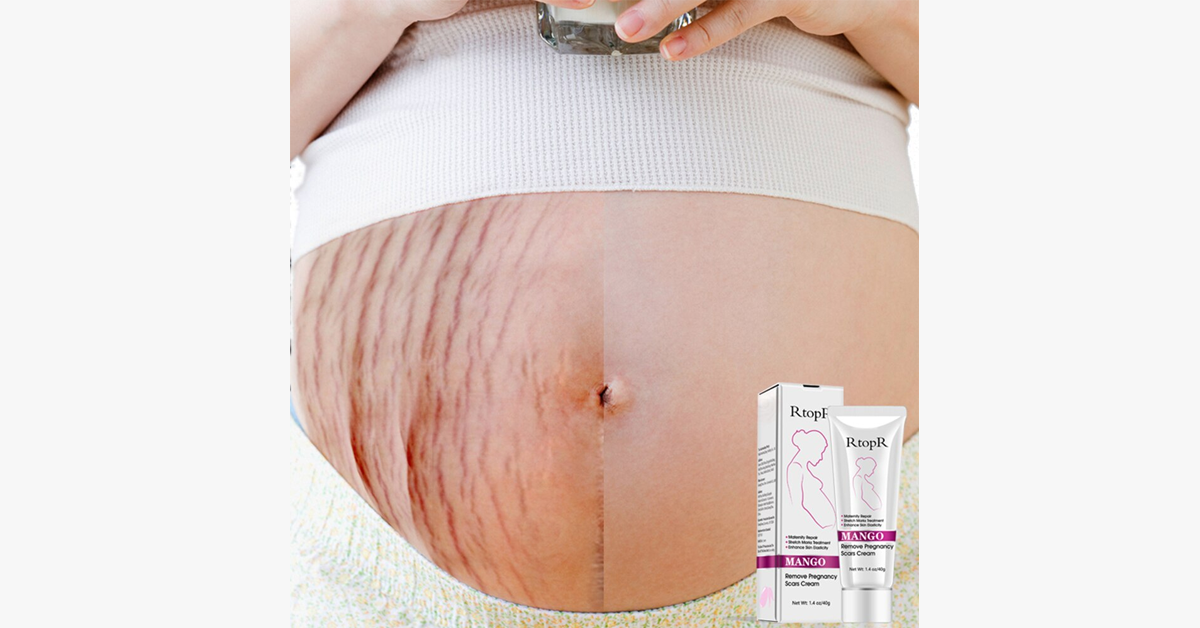 Pregnancy Scars and Stretch Mark Removal Cream