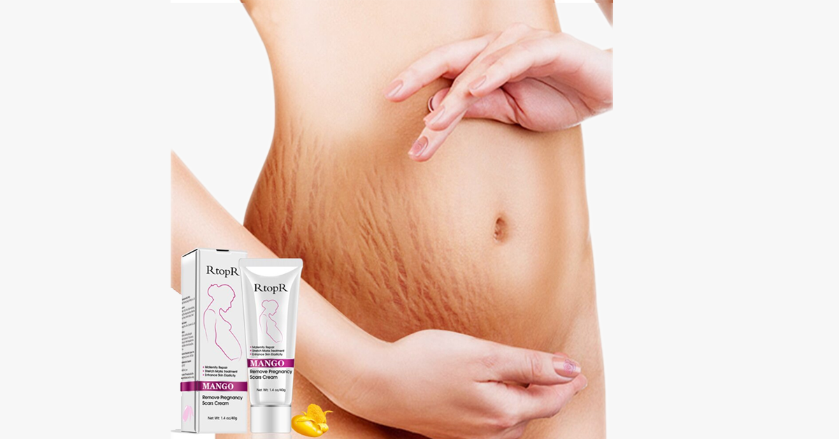 Pregnancy Scars and Stretch Mark Removal Cream