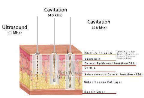 Ultrasonic Cavitation Cellulite Fat Removal Body Contouring Massager